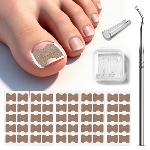 BALUCA 2025 Upgraded Ingrown Toenail Corrector Kit | Professional Ingrown Toenail Treatment & Pain Relief | Home Pedicure Tool Set with Breathable Corrector Strips & Toenail Tools - Image 1