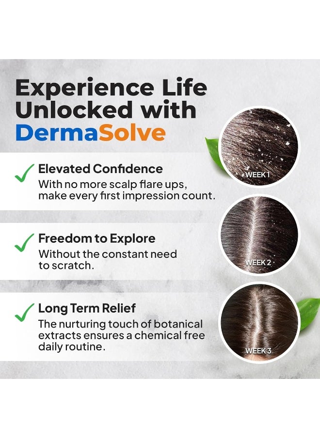 Dermasolve - Psoriasis & Dandruff Oil, Dermatologist Approved For Flaky Scalp Relief - Image 1