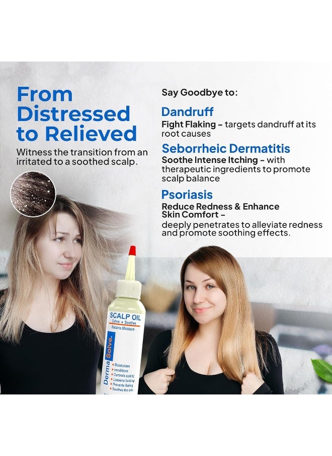 Dermasolve - Psoriasis & Dandruff Oil, Dermatologist Approved For Flaky Scalp Relief - Image 1