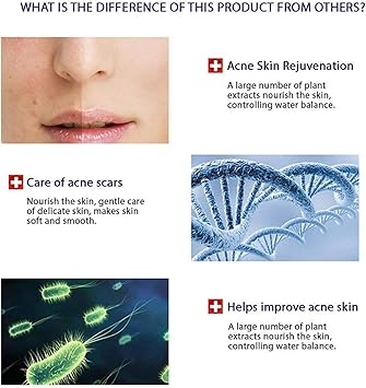 BIOAQUA 4in1 Face Acne Treatment Scar Removal Spots Whitening Oil Cream Face Masks Scar Blemish Marks Moisturizing Oil 100g30g30ml4pcs X30g - Image 3