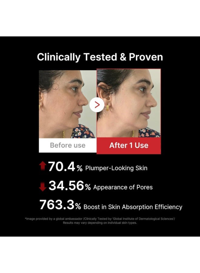 ميديكيوب AGE-R Booster Pro - أسود - Image 3