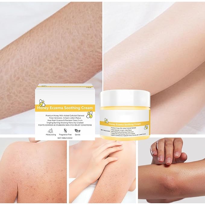 YOOJ Honey Soothing Cream for Dry Itchy Skin, 100g/3.53OZ Fragrance Free Gentle Moisturizing Cream with Colloidal Oatmeal, Soothing Face & Body Cream for Irritated Dry Cracked Rough Skin - Image 3