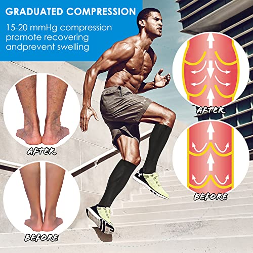 cerpite Zipper Compression Socks, 2 Pairs 15-20 mmHg Closed Toe Compression Stockings for Men Women - Image 2