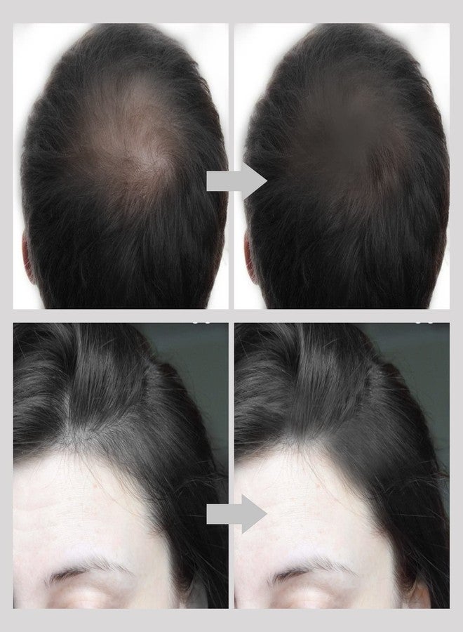 بوبين بودرة بوبين لتصحيح خط الشعر، لتغطية جذور الشعر الخفيف والشيب، وتغطية فورية، وكونسيلر متعدد الألوان - Image 2