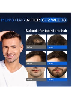 REMEDIAL PAX Hair Growth Serum, 5% Minохidil & Biоtin for Men and Women, Stop Hair Loss and Thinning, Natural Organic Growing Spray for Hair Regrowth, All Hair Types, 2 Fl Oz  - Image 3