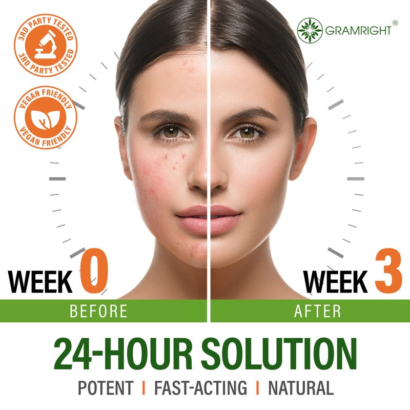 GRAMRIGHT Acne Face Cream - Acne Spot Treatment for Face & Acne Dots - Tea Tree Oil & Salicylic Acid - Natural Cystic Acne Treatment - Made in USA - For All Skin Types - Acne Scar Cream & Pimple Remover 4 fl.oz - Image 3