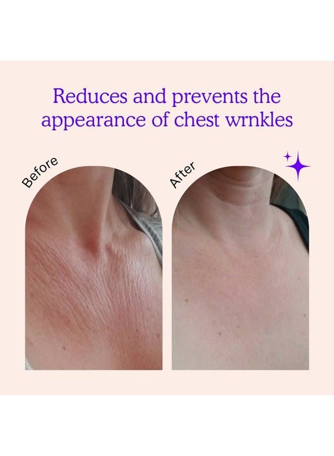 BLUMBODY Chest Wrinkle Pads - Anti-Aging Advanced Skin Firming Tightening & Moisturizing Treatment - Skin Safe Silicone Patches - Reusable Overnight Lift for Crepe Erase - Neck & Décolleté (1.5-mo Supply) - Image 2