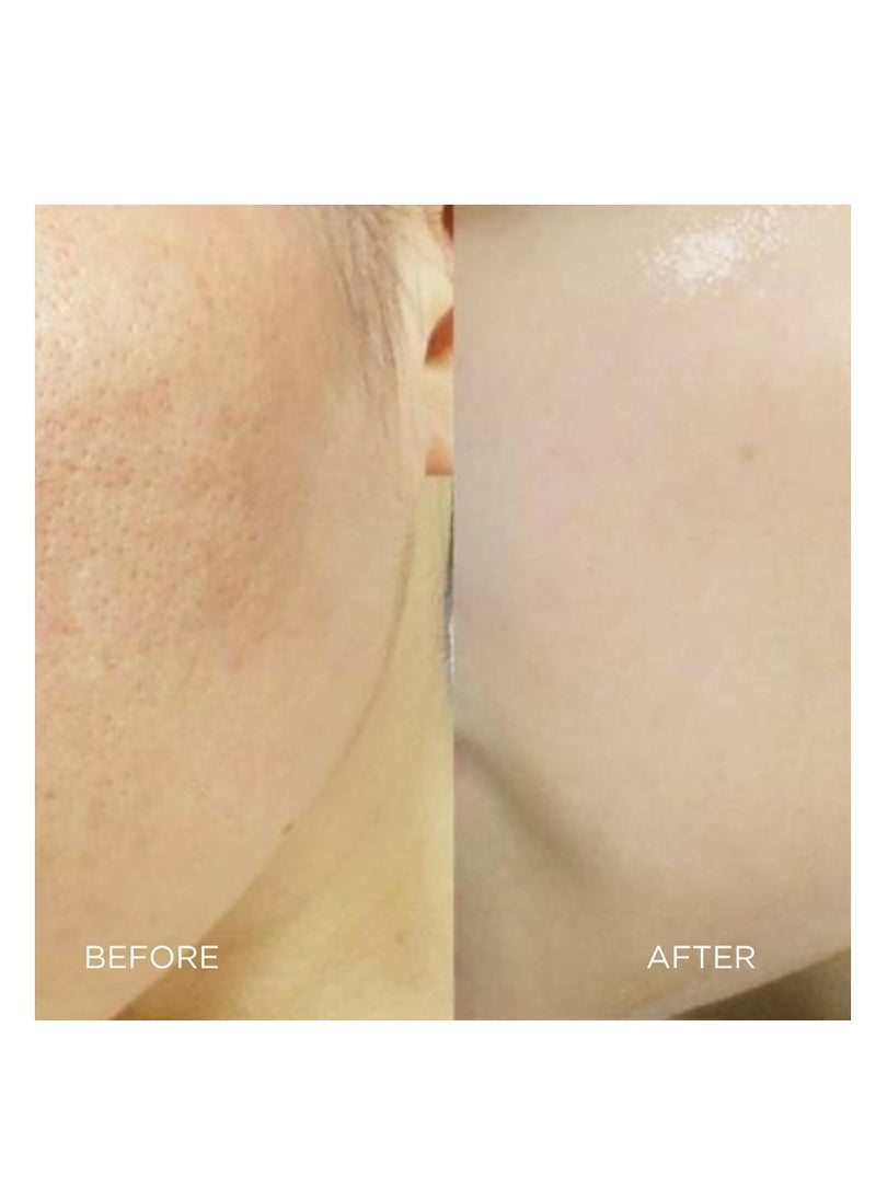 SKIN REPUBLIC - AHA 15% + PHA Face Serum, 30ml – Exfoliates, Smooths & Brightens Skin in 2 Weeks, Minimizes Pores & Roughness, Improves Texture & Radiance with Lactic, Glycolic & Mandelic Acids - Image 1