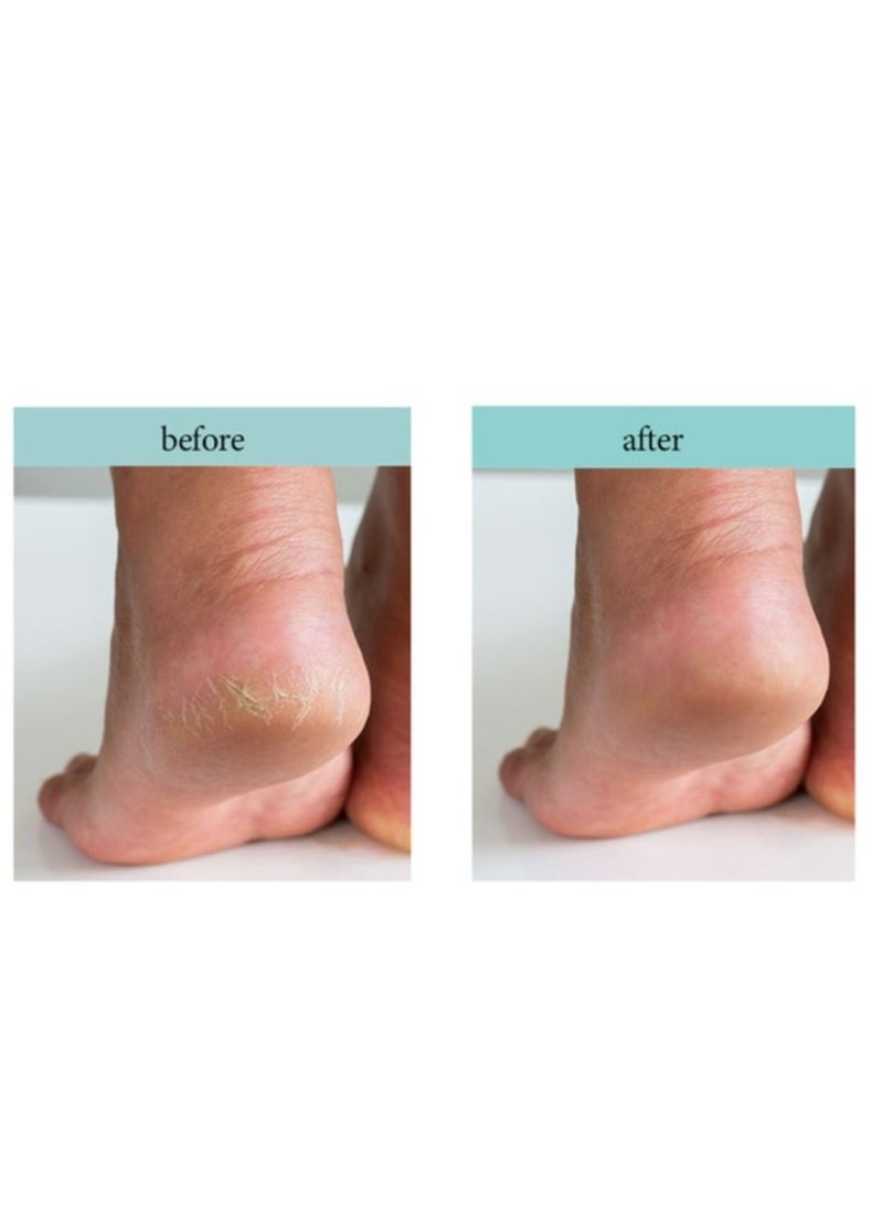 Eshumi Korean product Healing Foot Spa Cream - is an effective cream specially formulated to restore freshness and vitality to tired feet and legs 100ml - Image 5
