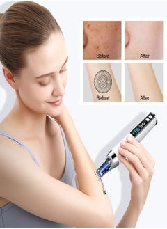 Generic Handheld Picosecond Skin Tattoo Dark Spot Removal Pen Beauty Device  - Image 4