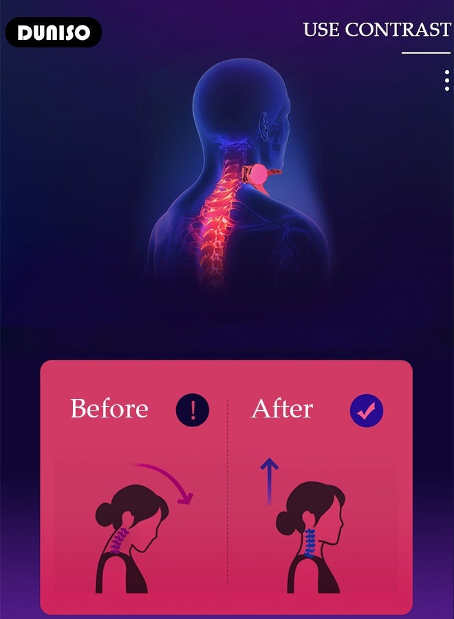 DUNISO نقالة الرقبة، دعامة للرقبة، دعم للرقبة قابل للتعديل 360 درجة. جهاز جر عنق الرحم المريح لمحاذاة الرقبة. مصحح وضعية الرقبة لتخفيف آلام الرقبة وتخفيف الضغط على العمود الفقري - Image 4