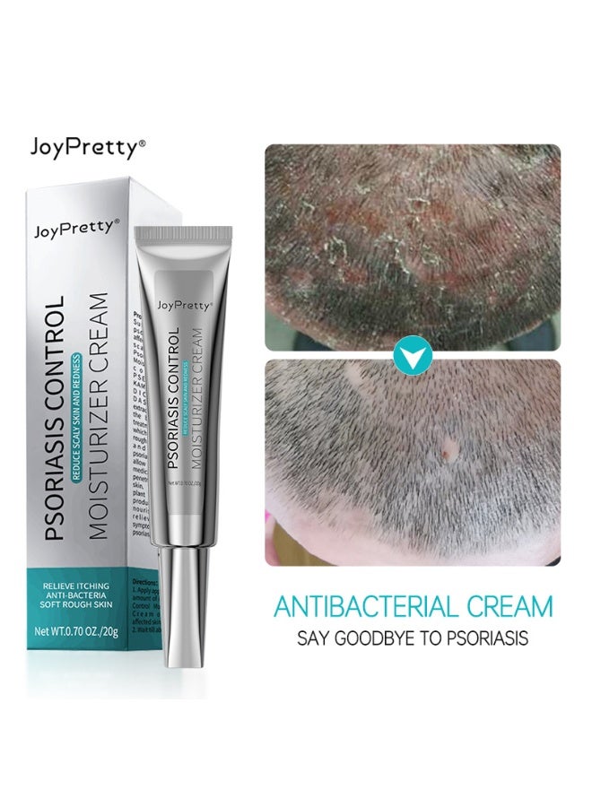 JoyPretty Psoriasis Relief Cream , Anti-Bacterial Moisturizer for Scaly Skin & Redness – Natural Herbal Cream for Eczema, Dermatitis, Psoriasis, and Vitiligo – Unisex (20g) - Image 1