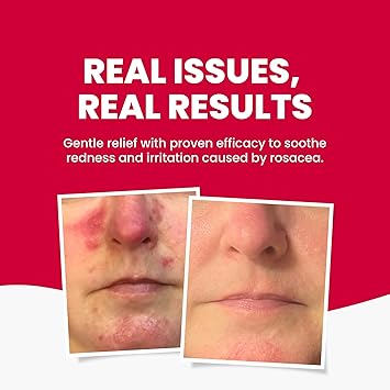 Grahams Natural غسول وجه غراهامز الطبيعي المضاد للاحمرار للبشرة المعرضة للاحمرار وحب الشباب الوردية معزز بالشاي الأخضر والألوة فيرا والخيار 1 × 125 مل - Image 3