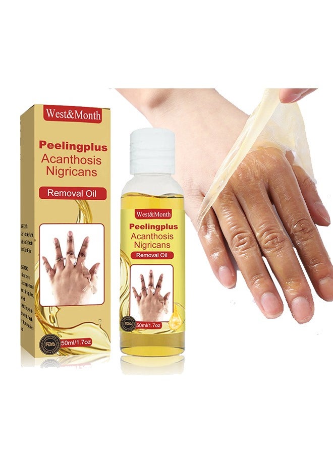 West&Month - Peeling Plus-Acanthosis NigricansRremoval Oil,Dark Spot Corrector Oil, Acanthosis Nigricans Treatment For Dark Knuckle Finger Elbow And Knee Removal 50ML - Image 1