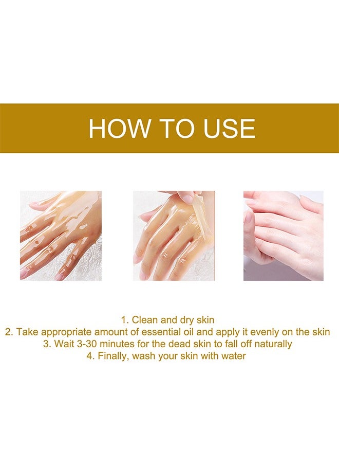 West&Month - Peeling Plus-Acanthosis NigricansRremoval Oil,Dark Spot Corrector Oil, Acanthosis Nigricans Treatment For Dark Knuckle Finger Elbow And Knee Removal 50ML - Image 1