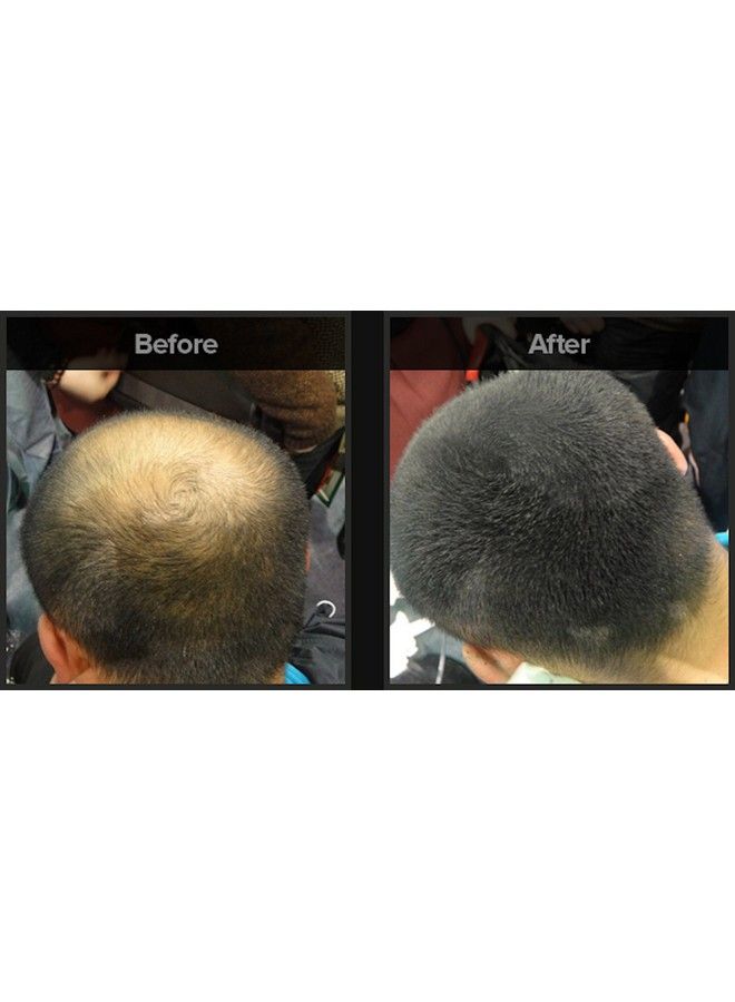 Fix-O-Fit Hair Fibers Dark Brown For Men And Women Natural Hair Thickening Fiber 22G - Image 5