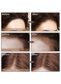JOVIALITY Hairline Powder Hair Root Touch Up,Hair Filler Volumizing Powder Fill In Receding Hair Lines Bald Spots Wide Parts Forehead Side,Hairline Finishing Stick Sweatproof For Women Men (Coffee)  - Image 4