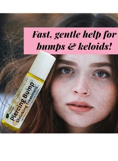 Urban ReLeaf Urban ReLeaf Piercing Bump Shrinking Treatment ! Gentle, Effective Aftercare. Easy Roller-Ball Applicator. 100% Natural with Essential Oils. Help Scars, Nodules, Cartilage, Nose, Ear Spots  - Image 4