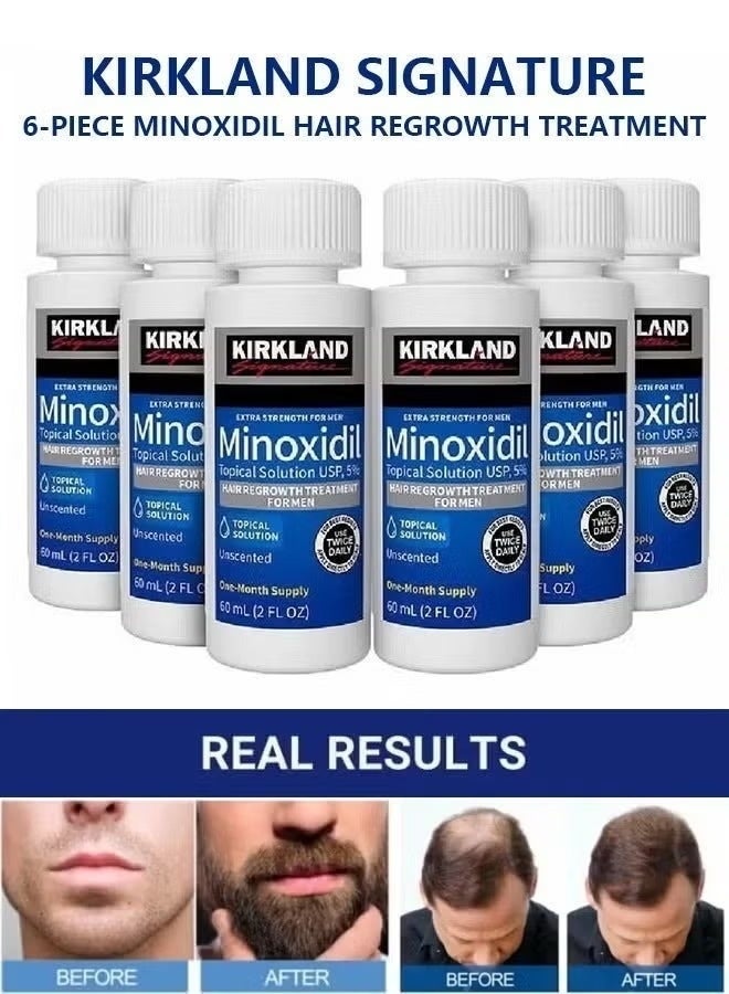 Kirkland Signature 6-Piece Minoxidil Hair Regrowth Treatment - Image 4