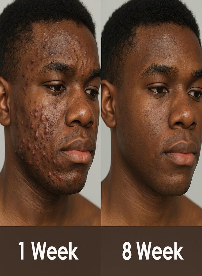 Peehss Turmeric Soap & Essential Oil Set, Including 6 Turmeric Kojic Soap & Essential Oils, Natural Lemon Honey Handmade Bar for Wash Face & Body, Jabon de Curcuma para Las Manchas Kit for Women & Men - Image 3