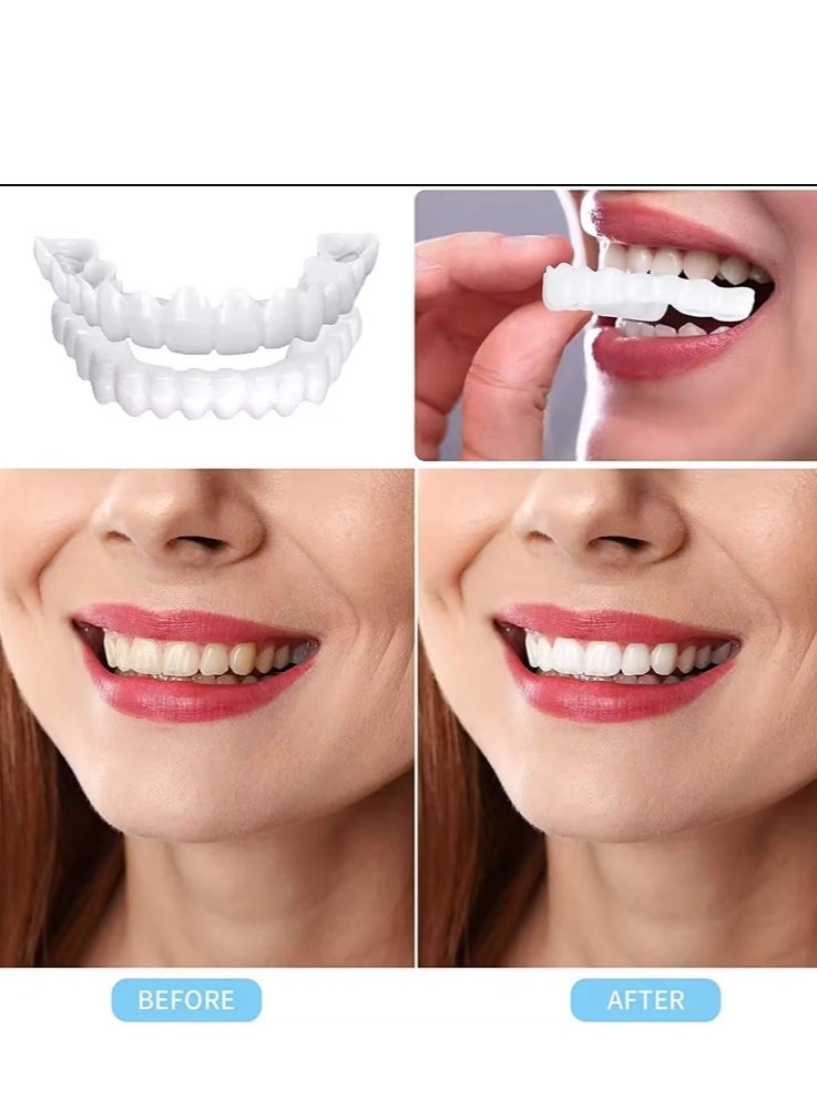 SNAP-ON - Adjustable Snap On Dentures, Temporary Teeth Repair Kit Correct Denture Alignment For Temporary Teeth Replacement - Image 1