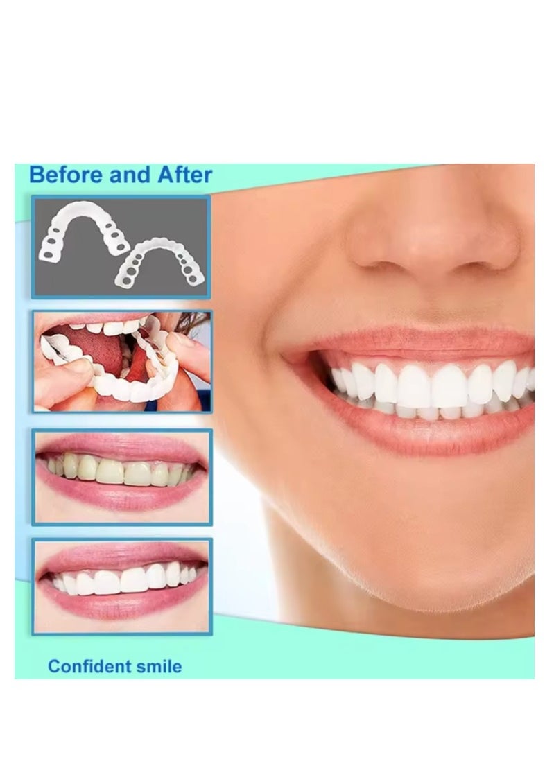 SNAP-ON - Adjustable Snap On Dentures, Temporary Teeth Repair Kit Correct Denture Alignment For Temporary Teeth Replacement - Image 1