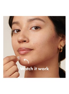 Hero Hero's Mighty Patch, Original Powerful Hydrocolloid Acne Pimple Patches for Effective Zit and Blemish Coverage - 36 Count for Clear and Smooth Skin  - Image 2