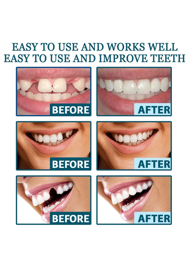 EELHOE EELHOE Adjustable snap-on dentures, upper and lower jaw cosmetic denture veneers, smile temporary dental restoration kit, instant confident  - Image 5