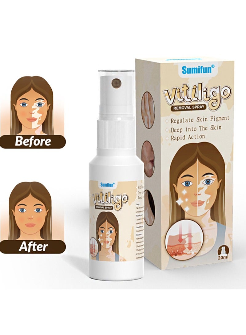 Sumifun Vitiligo Removal Spray，Natural Vitiligo Treatment for Skin, Reduces White Spots, Improves Skin Pigmentation, Easy to Use, Regulates Skin Pigmentation, Deep into the Skin, Fast Acting (20ml)  - Image 1