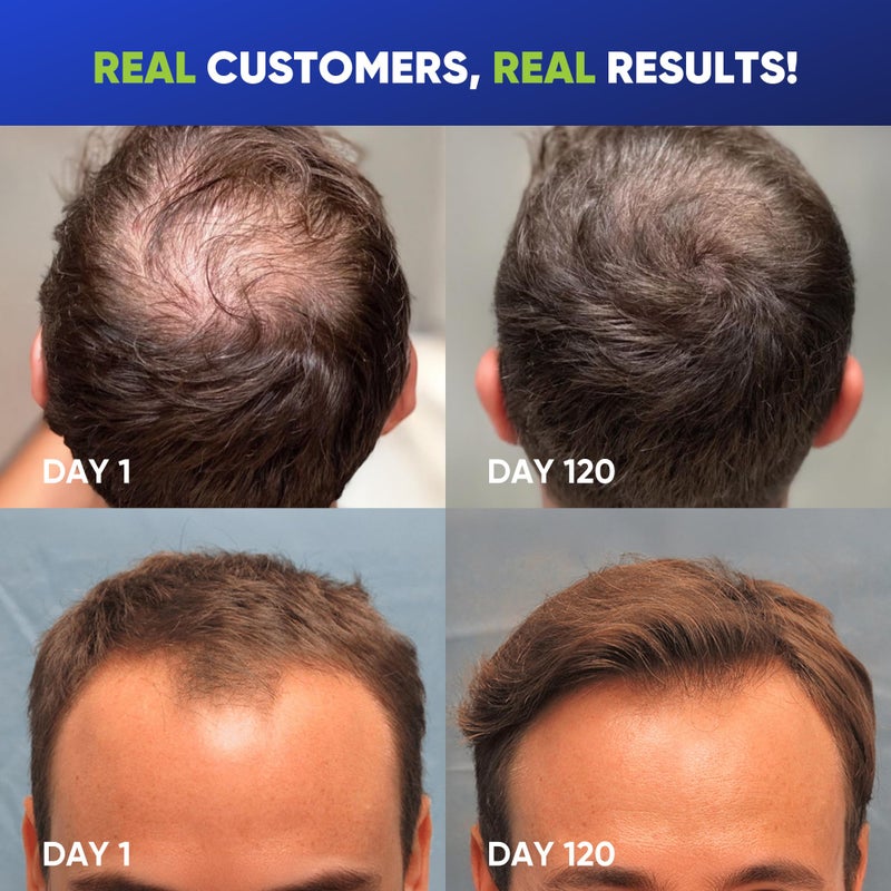 Svvimer Hair Growth Shampoo for Men - Biotin Thickening Shampoo with Rosemary Tea Tree Oil Caffeine for Hair Loss and Thinning - 13.5 Fl Oz (Pack of 1) - Image 3