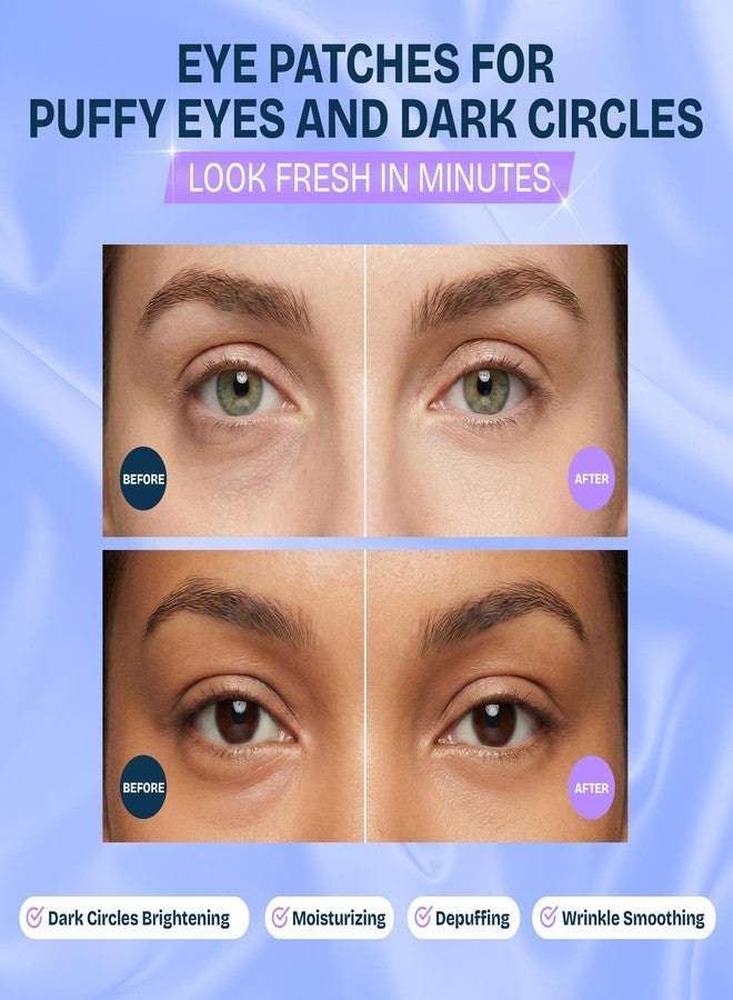 MAREE Under Eye Patches for Puffy Eyes and Dark Circles – Under Eye Mask with Collagen & Hyaluronic Acid – Undereye Mask Patches for Women – Parches para Ojeras Puffiness & Under Eye Bags | 12 Pair - Image 2