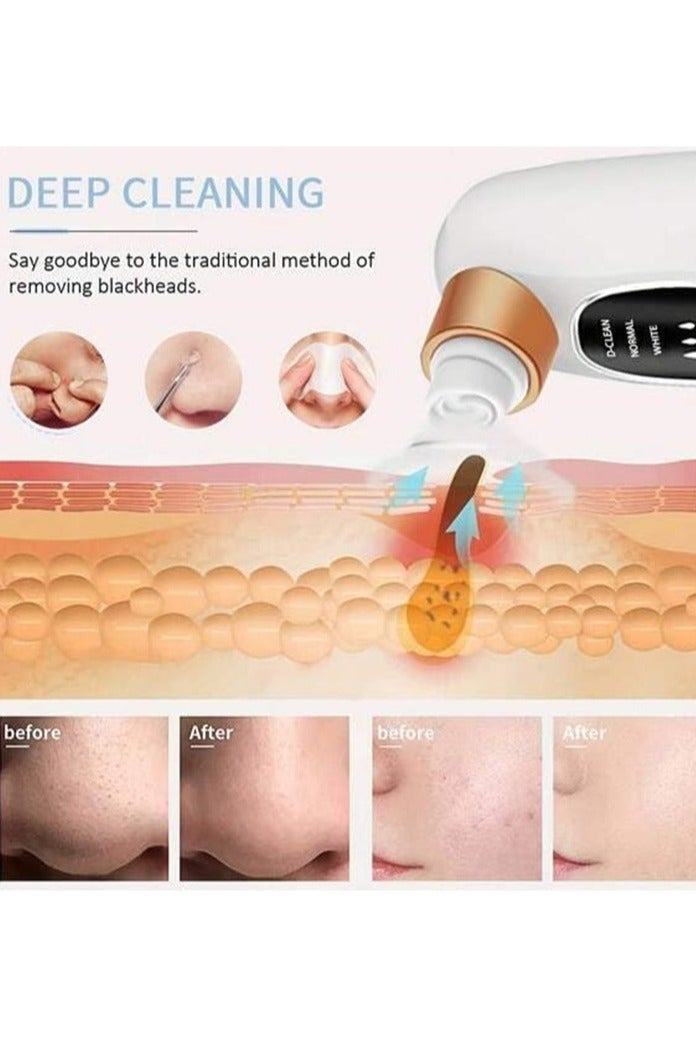 مزيل الرأس الأسود - Image 2