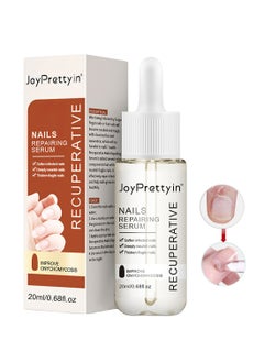JoyPretty Nails Repairing Serum, Onychomycosis Softening Solution, Repairing Gel for Discolored and Damage Nails Suitable for Fingernails and Toenails, 20ml  - Image 1