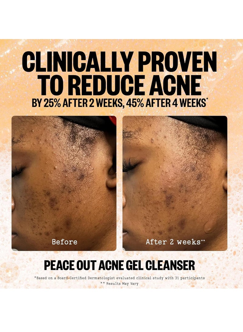 PEACE OUT Skincare Acne Gel Cleanser, Boost Skin Barrier and Help Diminish Blemishes, Daily Acne Face Wash with Salicylic Acid for Men and Women, 4 fl oz - Image 2