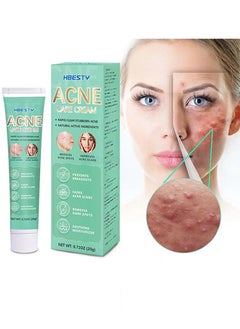 HBESTY Acne Care Cream，Oil Control Anti Acne Facial Care ，Acne Spot ，Cystic Acne，Fungal Acne ，Face Acne Spot Treatment and Acne Scar Treatment Post Acne Marks Treatment，Pimple Remover， Acne Repair  20g  - Image 1