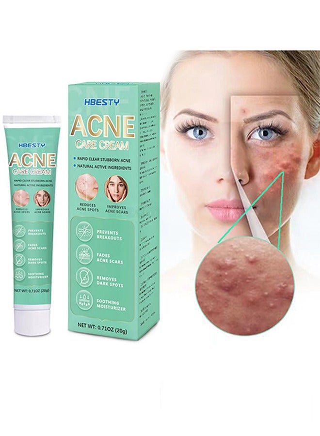 HBESTY Acne Care Cream，Oil Control Anti Acne Facial Care ，Acne Spot ，Cystic Acne，Fungal Acne ，Face Acne Spot Treatment and Acne Scar Treatment Post Acne Marks Treatment，Pimple Remover， Acne Repair  20g - Image 1