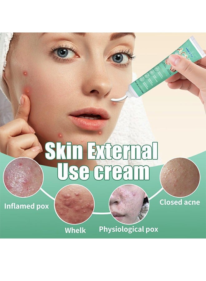 HBESTY Acne Care Cream，Oil Control Anti Acne Facial Care ，Acne Spot ，Cystic Acne，Fungal Acne ，Face Acne Spot Treatment and Acne Scar Treatment Post Acne Marks Treatment，Pimple Remover， Acne Repair  20g - Image 2