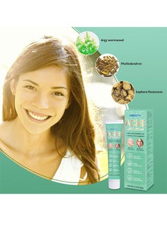 HBESTY Acne Care Cream，Oil Control Anti Acne Facial Care ，Acne Spot ，Cystic Acne，Fungal Acne ，Face Acne Spot Treatment and Acne Scar Treatment Post Acne Marks Treatment，Pimple Remover， Acne Repair  20g  - Image 4