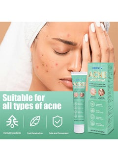 HBESTY Acne Care Cream，Oil Control Anti Acne Facial Care ，Acne Spot ，Cystic Acne，Fungal Acne ，Face Acne Spot Treatment and Acne Scar Treatment Post Acne Marks Treatment，Pimple Remover， Acne Repair  20g  - Image 3