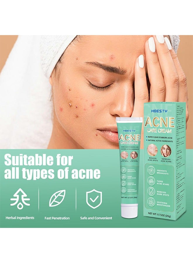 HBESTY Acne Care Cream，Oil Control Anti Acne Facial Care ，Acne Spot ，Cystic Acne，Fungal Acne ，Face Acne Spot Treatment and Acne Scar Treatment Post Acne Marks Treatment，Pimple Remover， Acne Repair  20g - Image 3