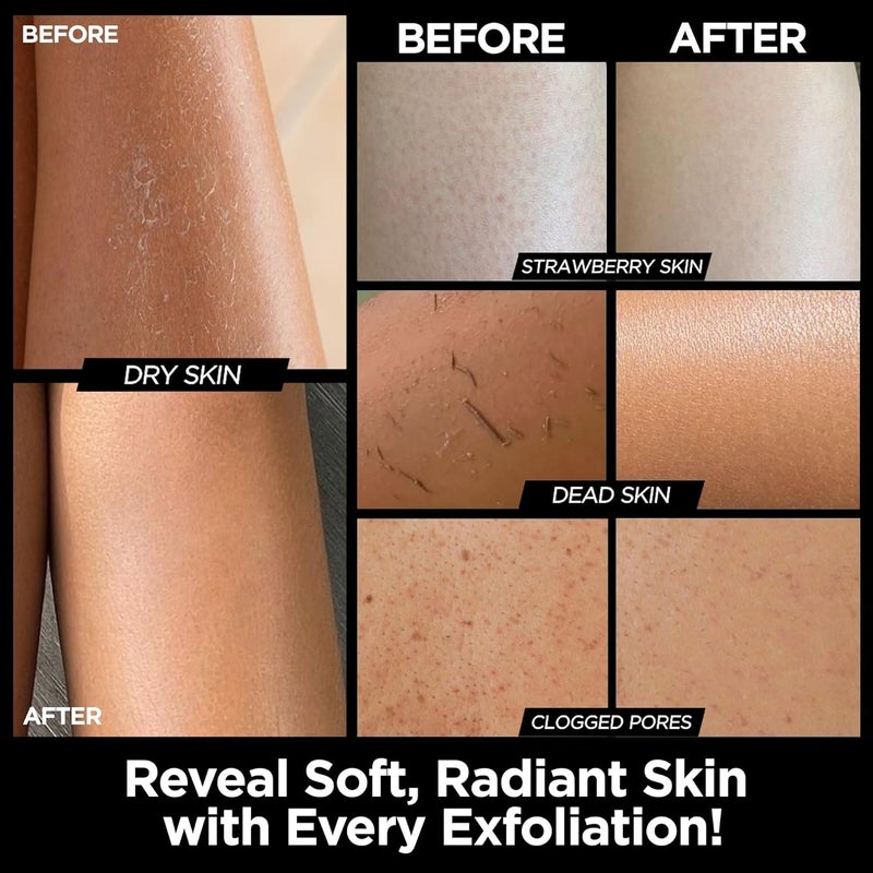 MS Exfoliating Glove Kessa Mitt Body Scrubber - Dead Skin Remover Shower Glove for Dead Skin Scrubbing and Deep Pore Cleansing - by MoroccanSource (1 Pack Black) - Image 2