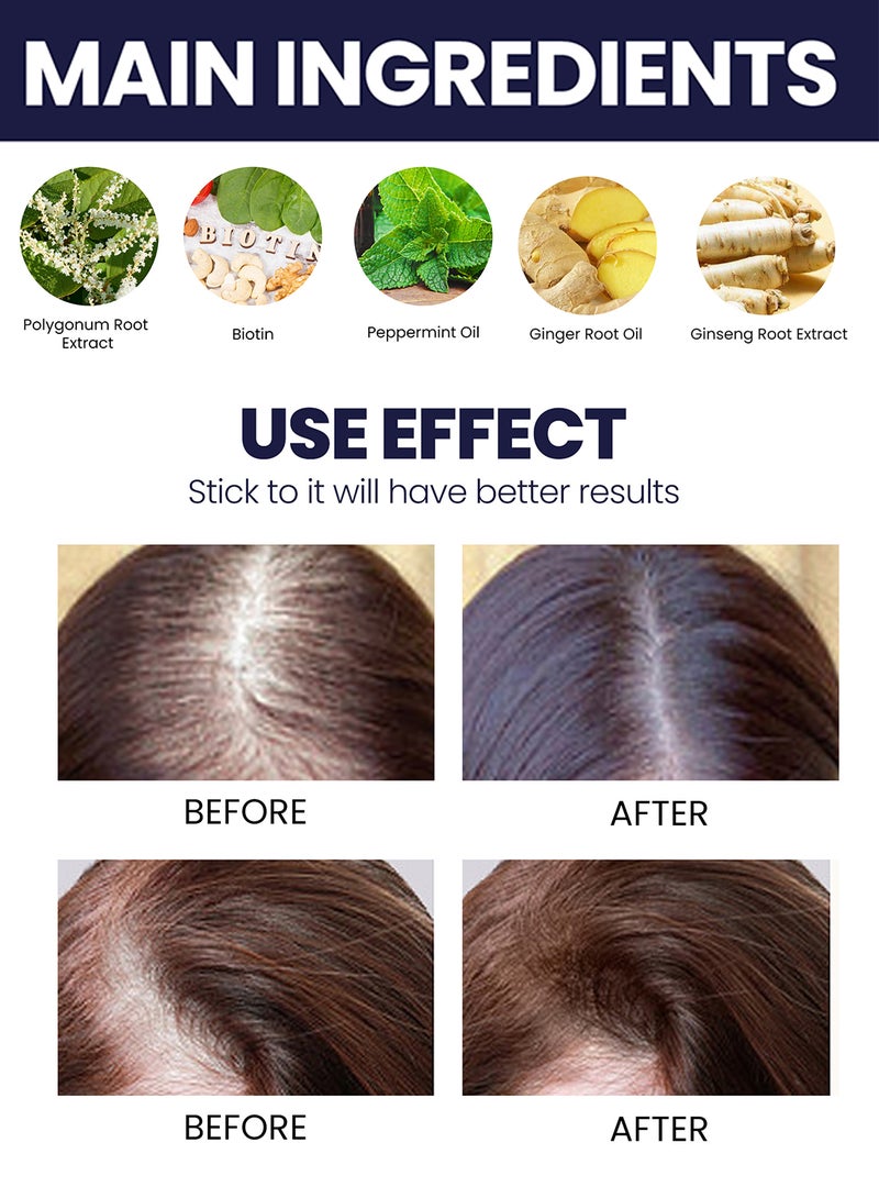 OUHOE 2Pcs Hair Growth Spray Set, Organic Hair Growth Serum, Hair Lotion, Hair Loss Treatments, Stimulate Healthy Hair Growth 50ml/Pcs - Image 5