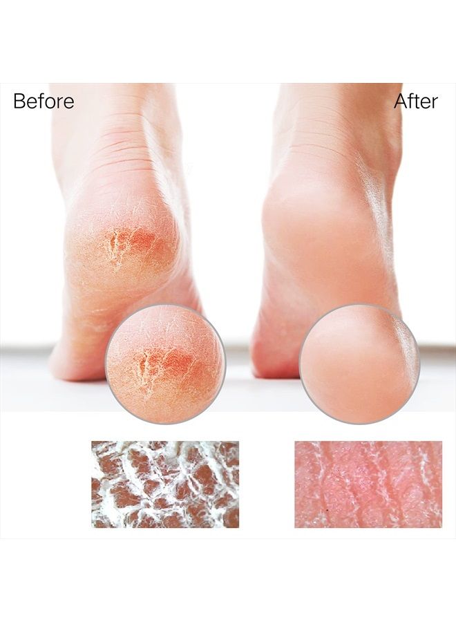 Sunivaca Glass Foot File Callus Remover for Feet, Heel Scraper, Pumice Stone, Diabetic Feet Scrubber Dead Skin Remover for Feet Professional Pedicure Tools - Image 4