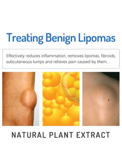 SOUTH MOON Lipoma Cream Lump Free Lipoma Removal Cream Herbal Lipoma Lumps Removal and Nodular Discomfort Ointment Reduce Fatty Lumps Easy to Absorb Safe and Effective Lipoma Treatment 20g  - Image 4