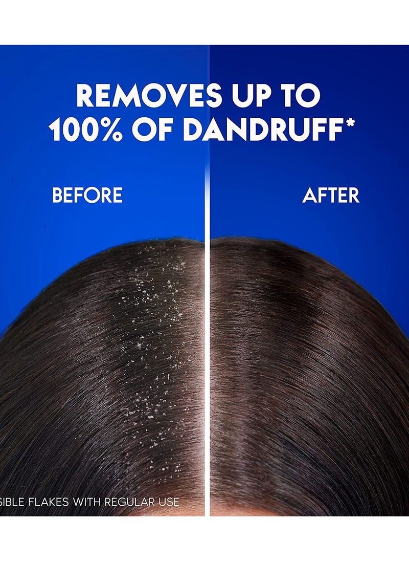 Head & Shoulders Smooth And Silky Anti-Dandruff Shampoo, 2 X 400 ML