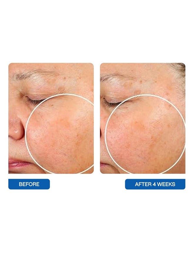 BeautyStat Universal Microbiome Barrier Repair Purifying Cleanser - Gentle Detoxifying Cleanser with Medical Grade MicroSilverBG to Protect Skin and Promote a Healthy, Radiant Glow (5 oz / 150ml) - Image 5