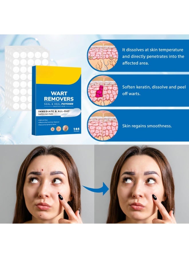 لاصقات إزالة الثآليل، 144 قطعة من ملصقات العناية بالبشرة سريعة وفعالة مضادة للماء من الهيدروكولويد لجميع أنواع البشرة، العناية بتنظيف الشامات الجلدية، مسامير القدم، الأشواك، الثآليل، الحبيبات، الثآليل الحادة، الخيوط - Image 3