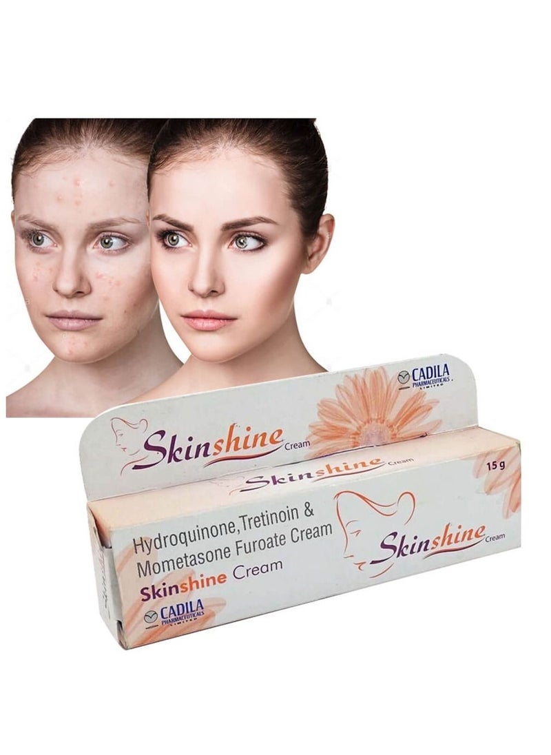 CADILA - Indian Skin Shine Cream for the treatment of melasma and acne 30 gm - Image 1