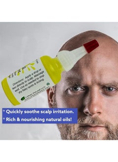 Urban ReLeaf Itchy Scalp Oil Treatment ! Braids, Wigs, Weaves, Tight & Itchy Skin Relief, Shaved Bald Head, Quickly Stops Irritation, Natural Herbal Remedy, Made Fresh in USA!  - Image 3