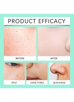 MOOYAM Anti-Aging Facial Peel Pads Anti-Aging, 35% Glycolic Acid , Peeling/AHA Alcohol-Free, Acne Treatment Pads, Anti-aging,Exfoliating Chemical Peel Pad, Acne Control Pads for Pimple Breakout, Clear Skin, 50 Pads  - Image 2